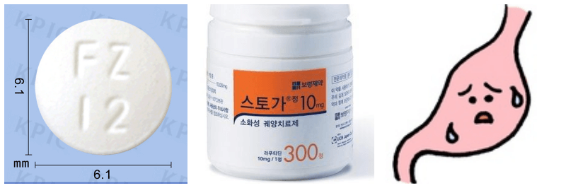 스토가정, 위궤양 사진