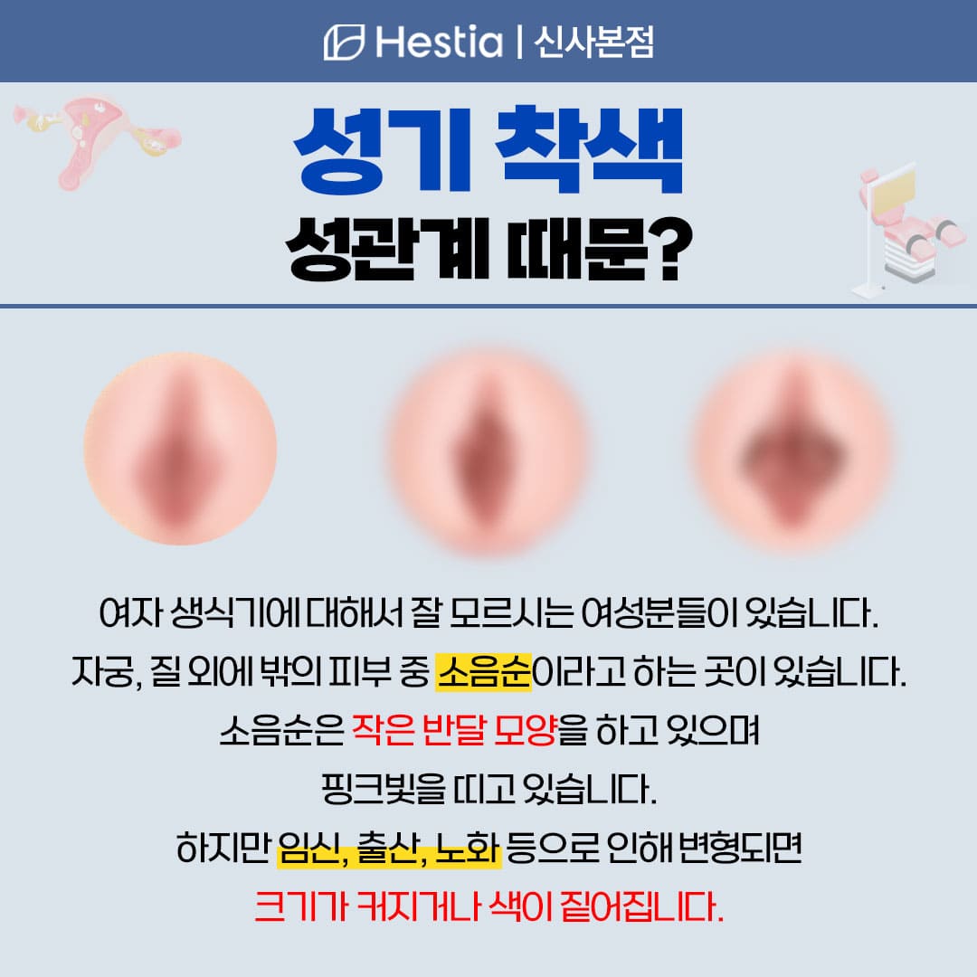성기 착색 성관계 때문?