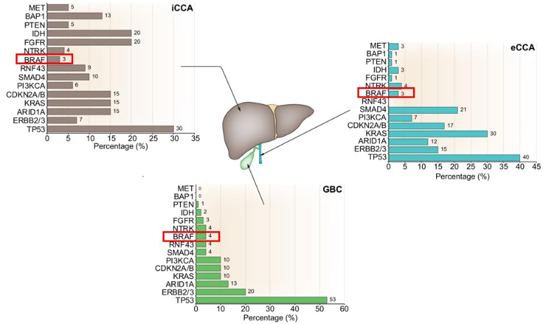 담도암 치료법: 수술&amp;#44; 항암&amp;#44; 면역요법