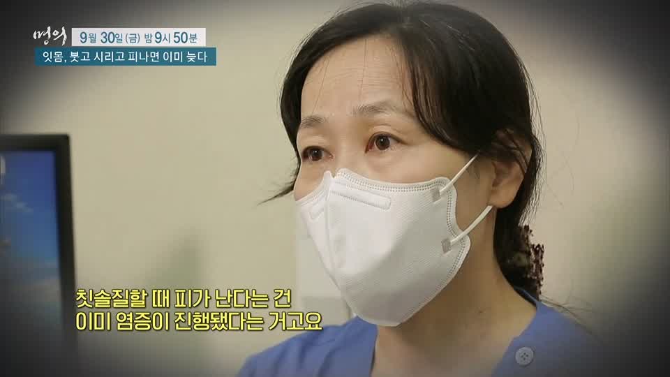 명의 붓고, 시리고, 피나면 이미 늦는 치주염 잇몸 질환 치주질환 치료, 예방 방법