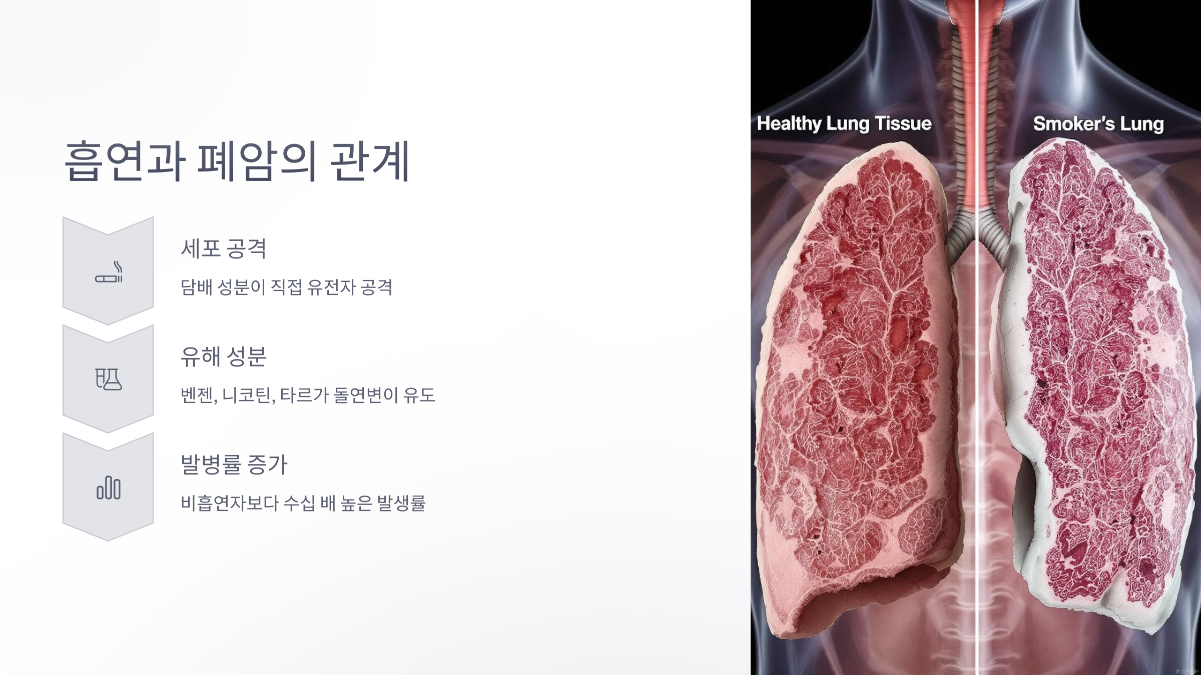 흡연과 폐암의 관계