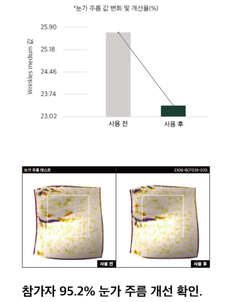메디톨드악시크림결과1