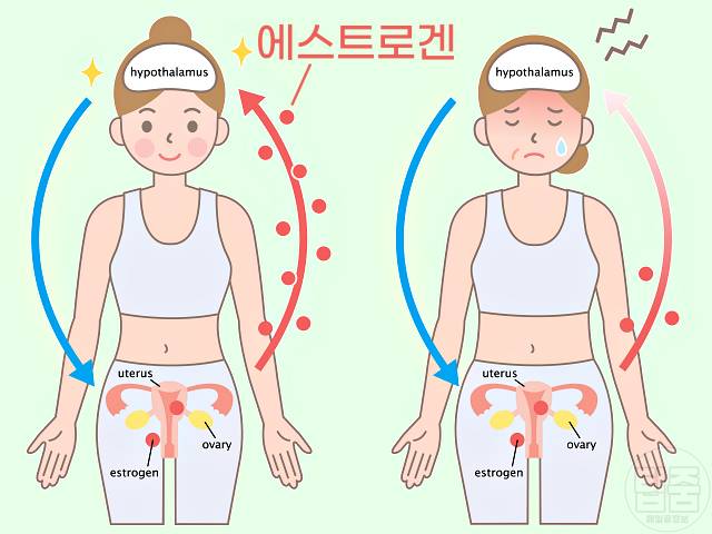 소변이 새요 요실금 원인 폐경 갱년기