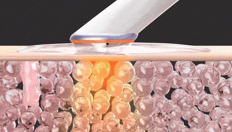 마데카 프라임 흡수 모드