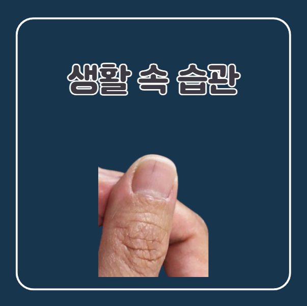 손톱 생활 속 실천습관 및 관리법