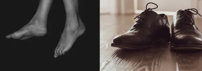 족저근막염 원인