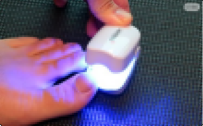 발톱무좀 치료 방법 및 예방법2