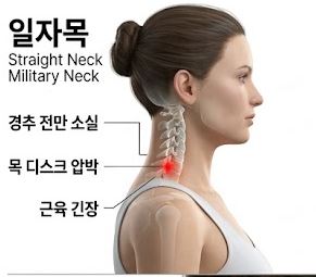 일자목