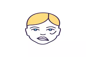 뇌졸중 전조증상