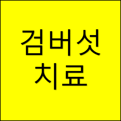 검버섯 치료 썸네일