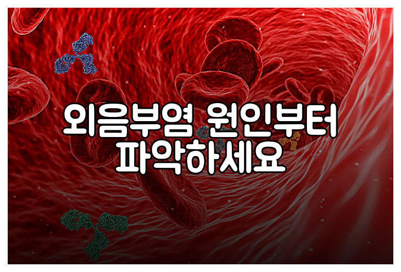 외음부염 원인부터 파악하세요