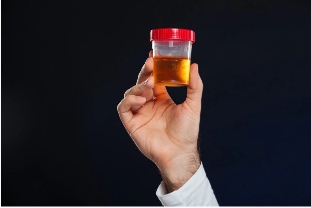 오줌 색깔과 병