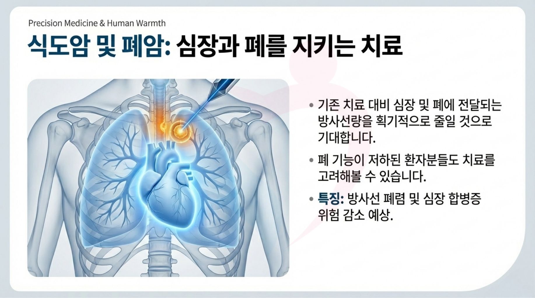 일본 중부국제의료센터 양성자치료 최신장비 ProBeam360