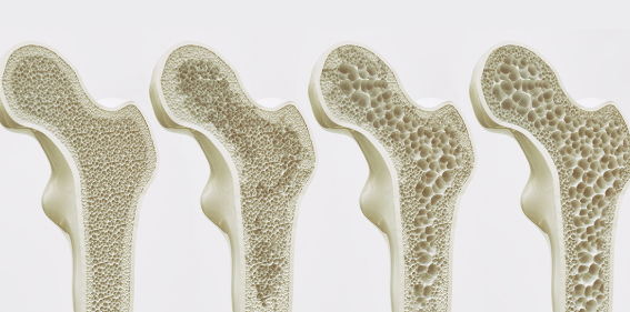 콘드로이친 효능