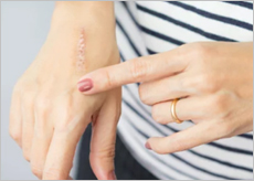 알부민의 효능으로 건강해진 사람들 이미지