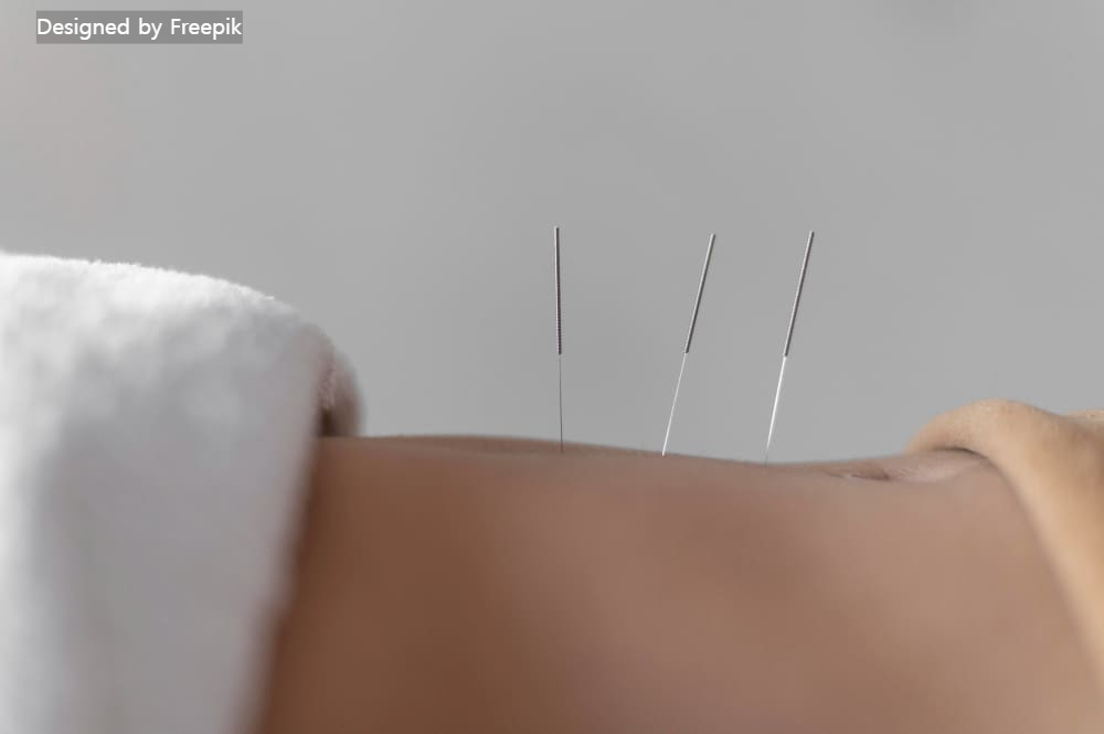 8체질 자가진단