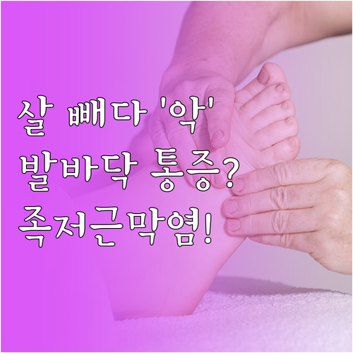 체중 감량 시 발바닥 통증 주의사항 ..