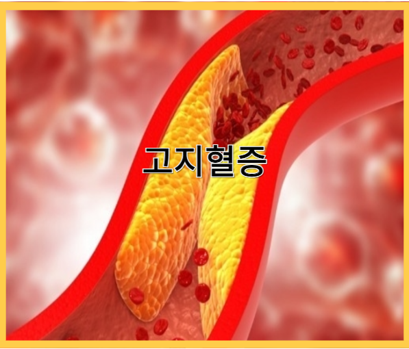 하이퍼셀 오메가3 - 고지혈증 예방