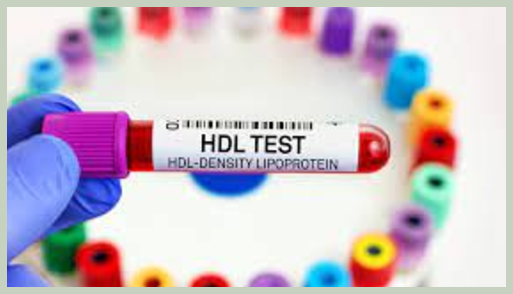 HDL 콜레스테롤 정상수치