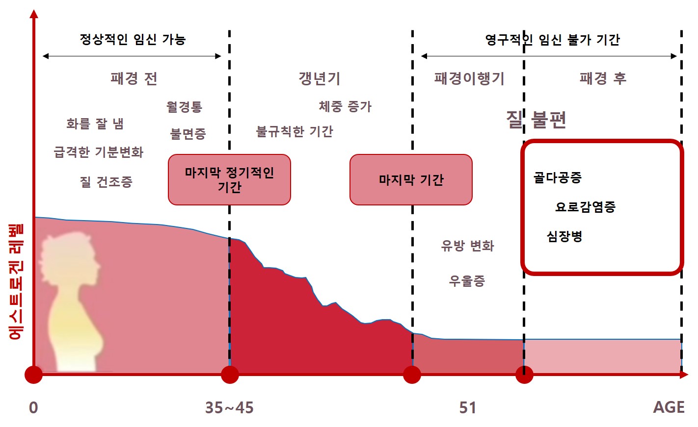 갱년기