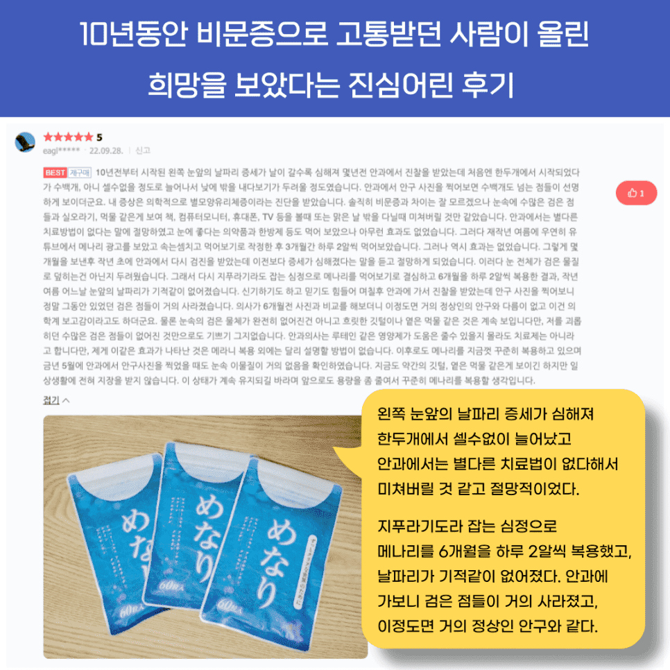 비문증 눈영양제