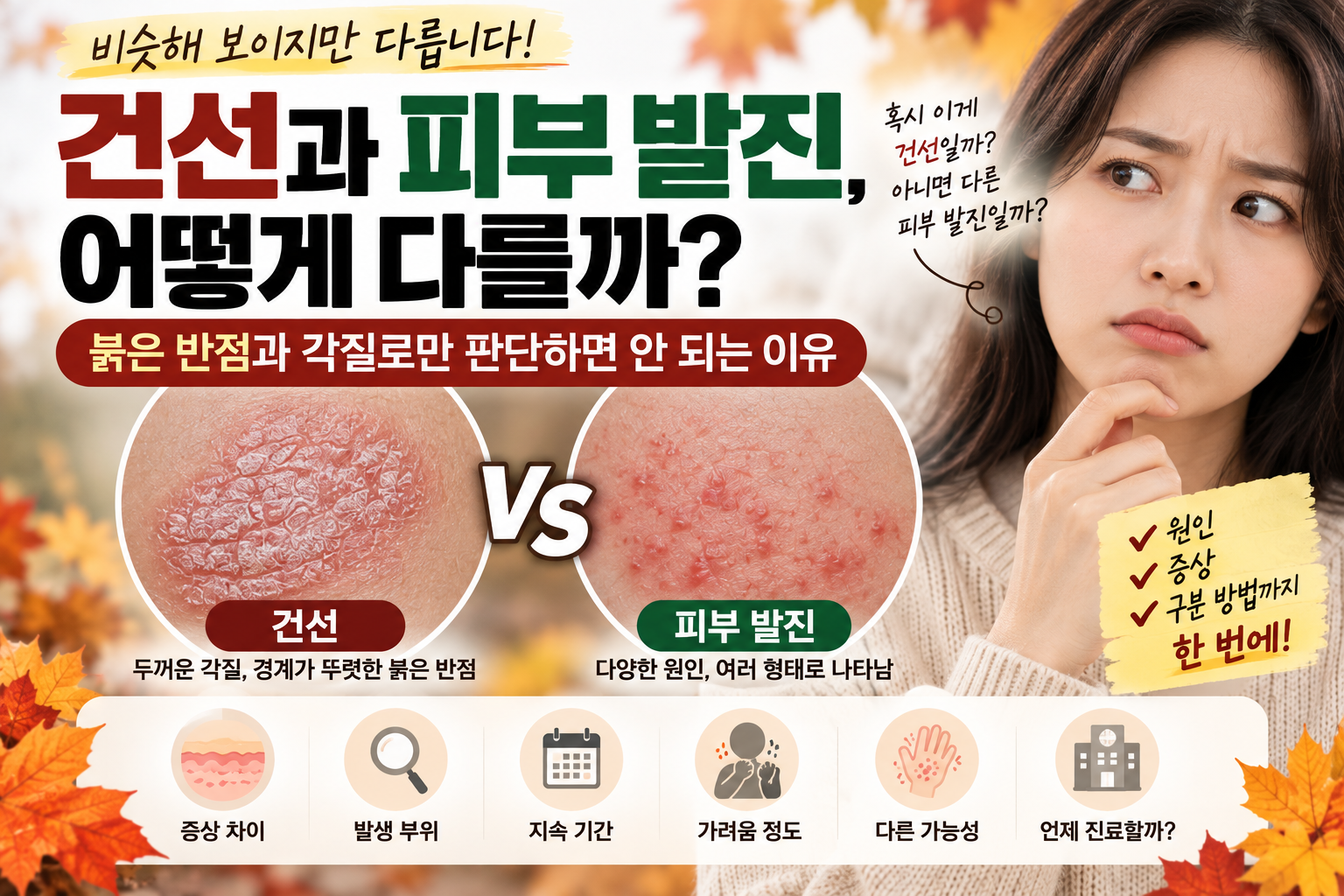 건선과 피부 발진 어떻게 다를까?