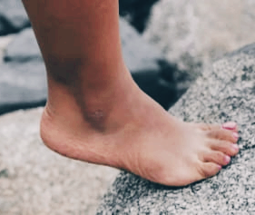 티눈 없애는 방법