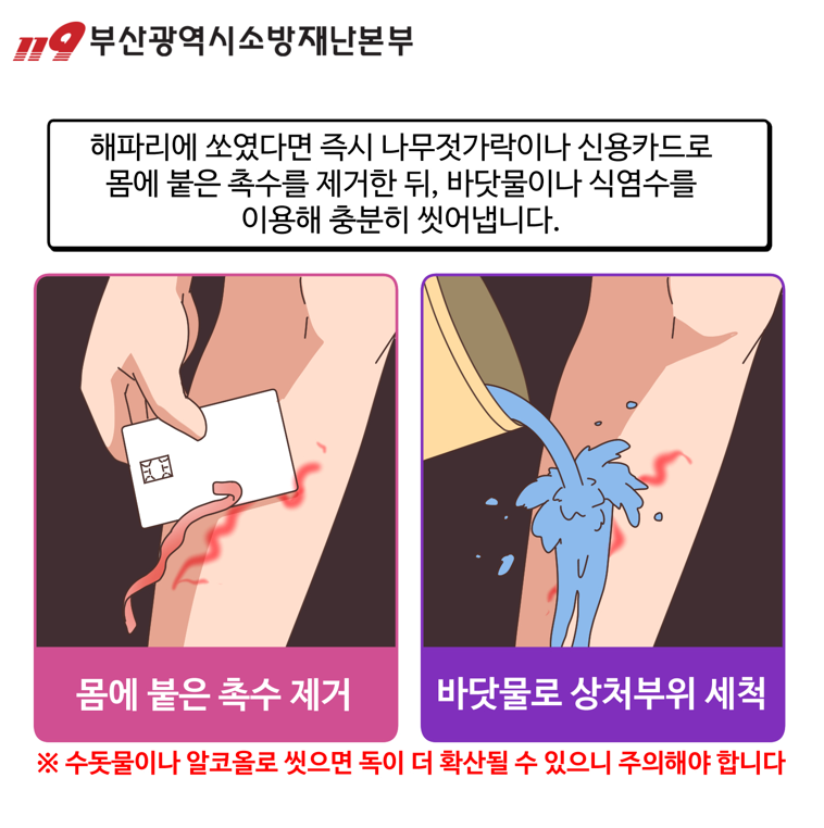 해파리 쏘였을때 관련 이미지3