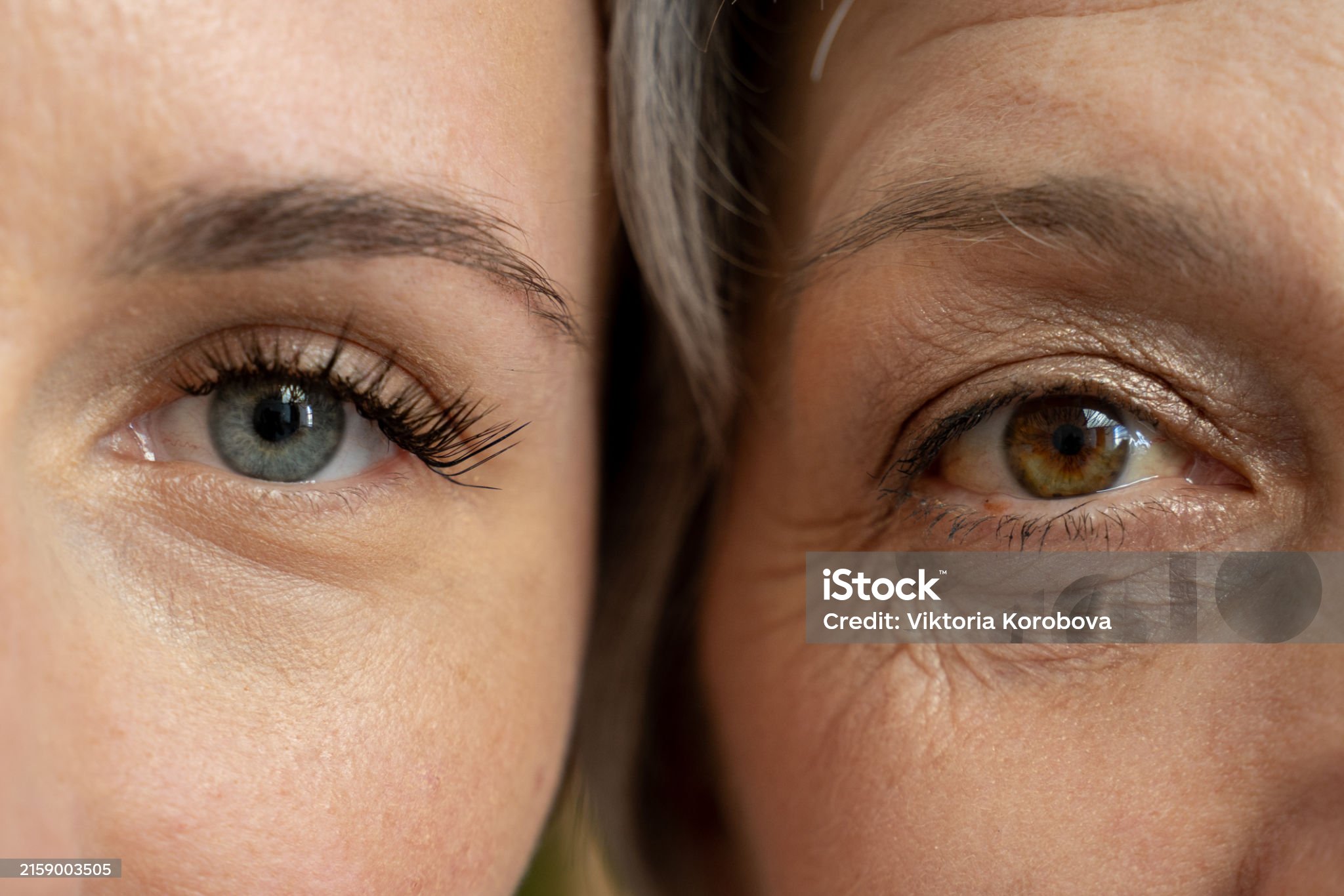 노화매커니즘-관련-사진