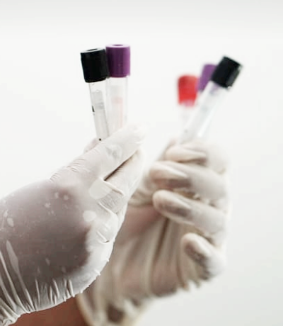 혈액암 증상과 초기증상&amp;#44; 생존율은?