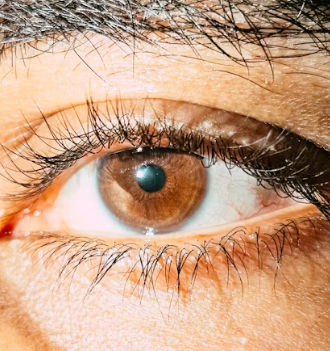 황반변성 치료법 자가진단 방법 합병증