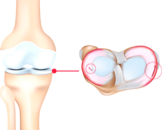 콘드로이친 효능 부작용