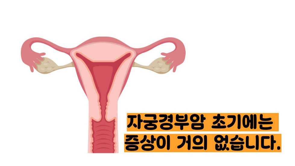 자궁경부암 증상