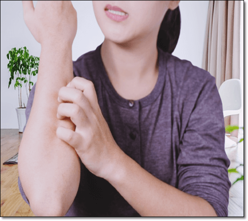 가지 알레르기로 가려운 여성