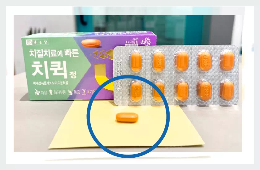 치퀵정