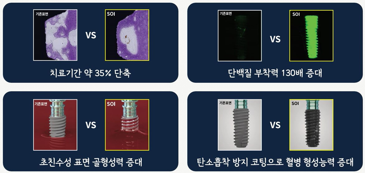 최고등급 SOI 장점