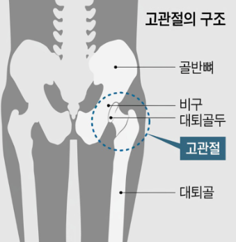 고관절 구조