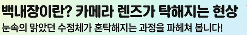 백내장 수술