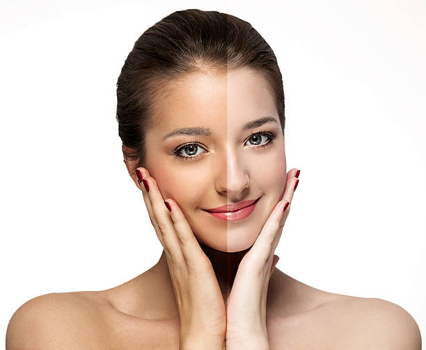 화이트 태닝 이미지