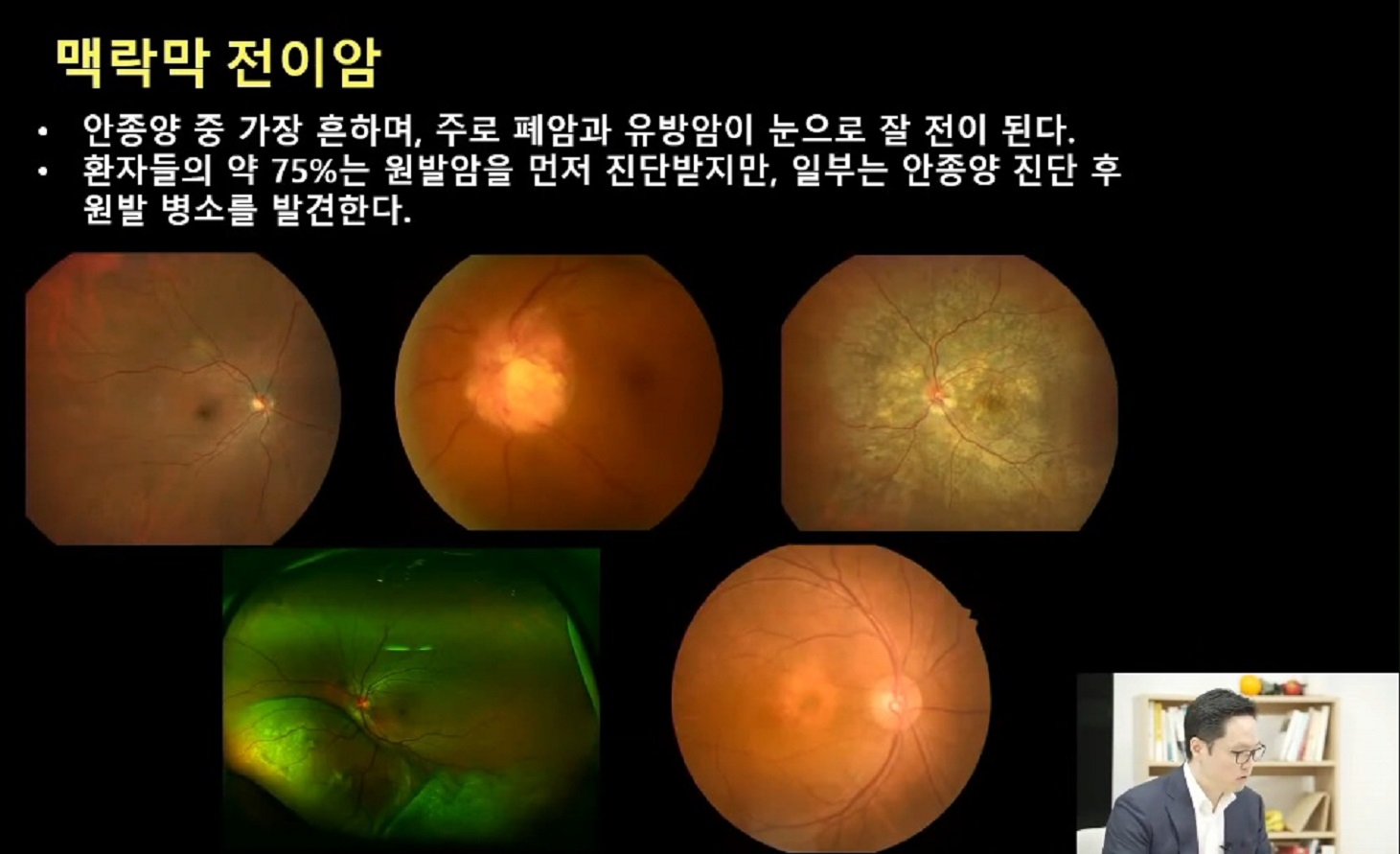 안구종양-안과-김민-교수