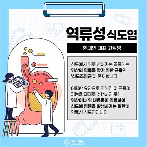 역류성식도염
