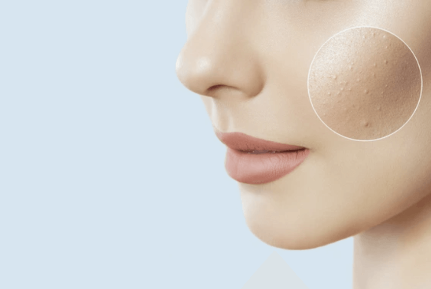 40대 피부과 의사가 추천하는 피부 재생 크림 베스트 넘버5!