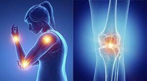 관절 영양제 추천 순위 (내돈내산 솔직후기)