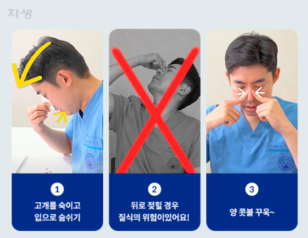 코피나는이유 계속 많이 자주 아이 어른 원인 지혈