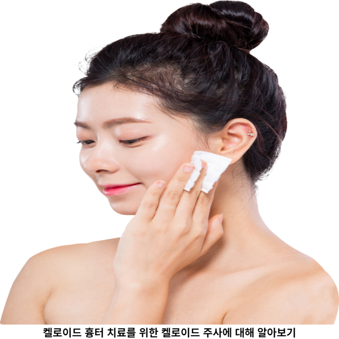 2. 켈로이드 흉터 / 원인