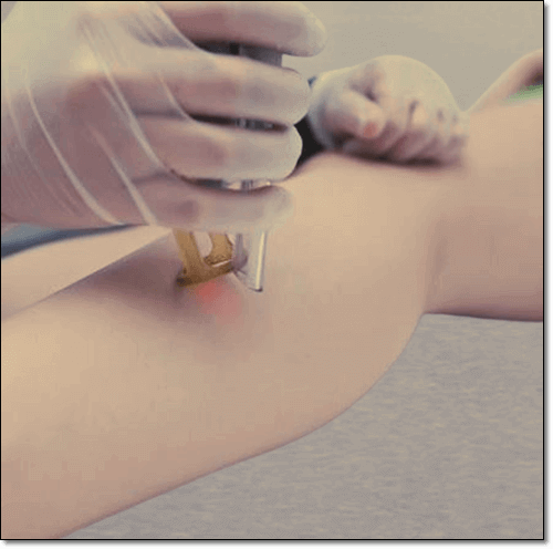 골육종 증상 의심 신호 5가지