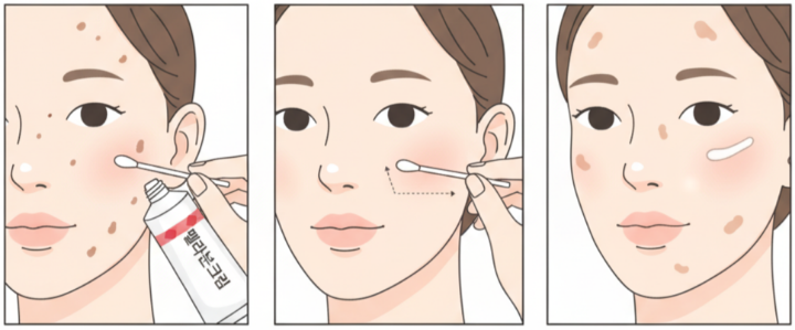 멜라논크림 바르는 방법 일러스트