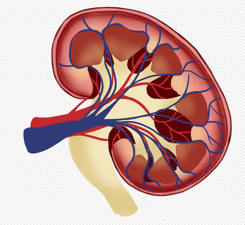 신장 낭종 증상