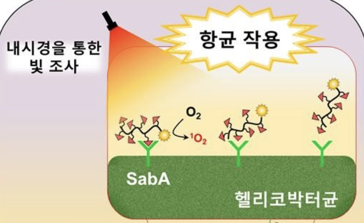 헬리코박터균 11