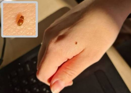 세스코 권연벌레,세스코 권연벌레 가격,권연벌레 퇴치 방법,권연벌레 살충제,권연벌레 박멸,권연 침벌 퇴치